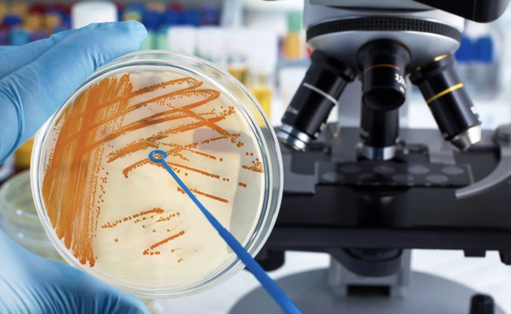 Microbiology culture plate used to test hospital wastewater for pathogens